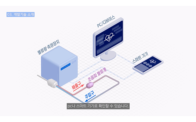 대구경북과학기술원 - 초음파혈류량 측정장치