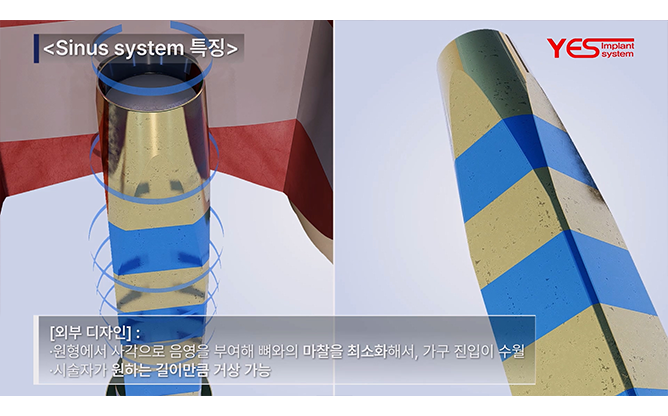 예스바이오테크 - 임플란트 시스템