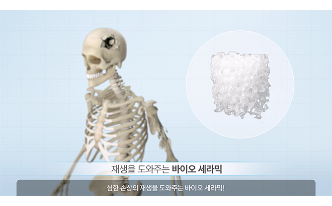 한국재료연구원 - 바이오 세라믹 잉크 3D 프린팅