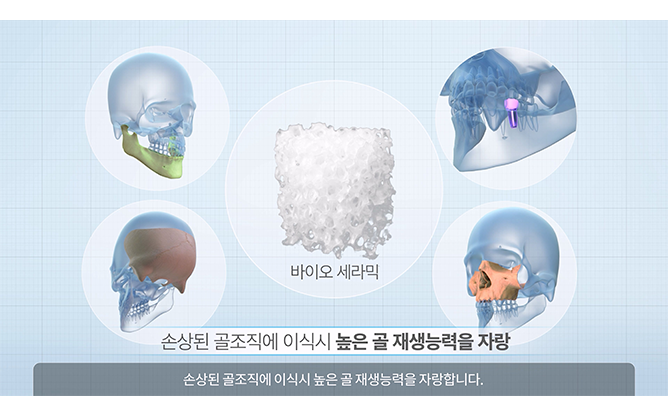 한국재료연구원 - 바이오 세라믹 잉크 3D 프린팅