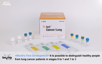바이오메트릭스 테크놀로지 - 폐암선별검사