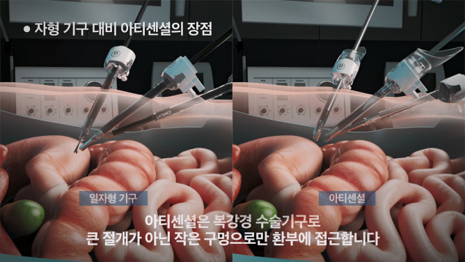 (주)리브스메드 - 복강경 수술기구