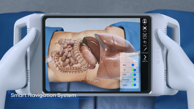 스키아 - 수술용 네비게이션