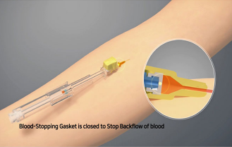 (주)메디퍼스트 - 카테터 허브 및 역류방지카테터