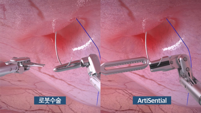 (주)리브스메드 - 복강경 수술기구