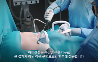 (주)리브스메드 - 복강경 수술기구