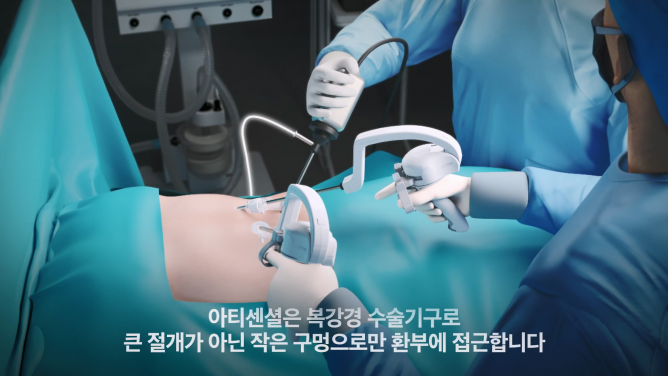 (주)리브스메드 - 복강경 수술기구