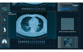 주식회사 클라리파이  - AI 의료영상 솔루션 기업