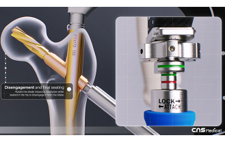 씨앤에스메디칼(주) - 신경 의료기기