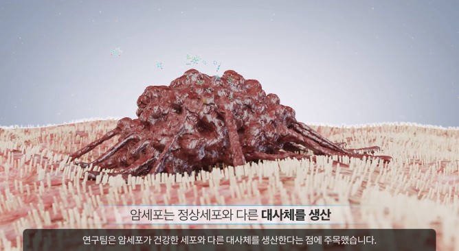 한국재료연구원 - 암검진 시스템